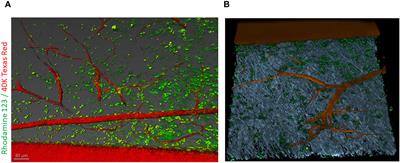 Editorial: Cause or effect: role of inflammation in metabolic disorder